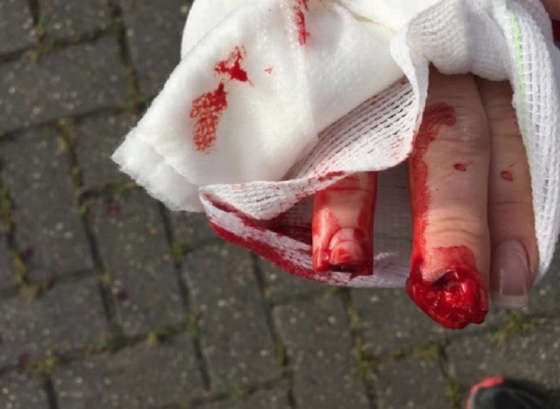 Other image for Posties suffer horrific dog attack injuries